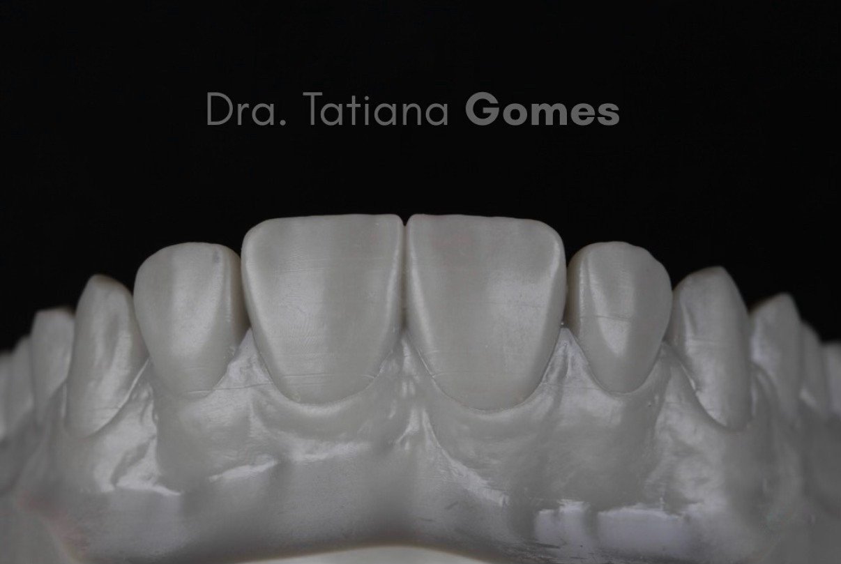 Design do sorriso